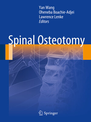 cover image of Spinal Osteotomy
